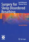 surgery-for-sleep-disordered-breathing