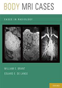 body-mri-cases