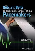 nuts-and-bolts-of-implantable-device-therapy