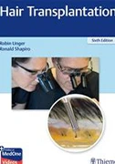 hair-transplantation